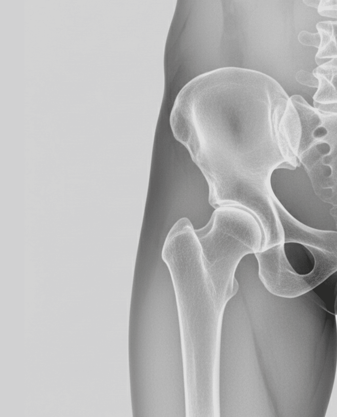 Capacitación en cirugía de hombro mínimamente invasiva.